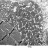 3B10 Case 3 EM005 - Copy