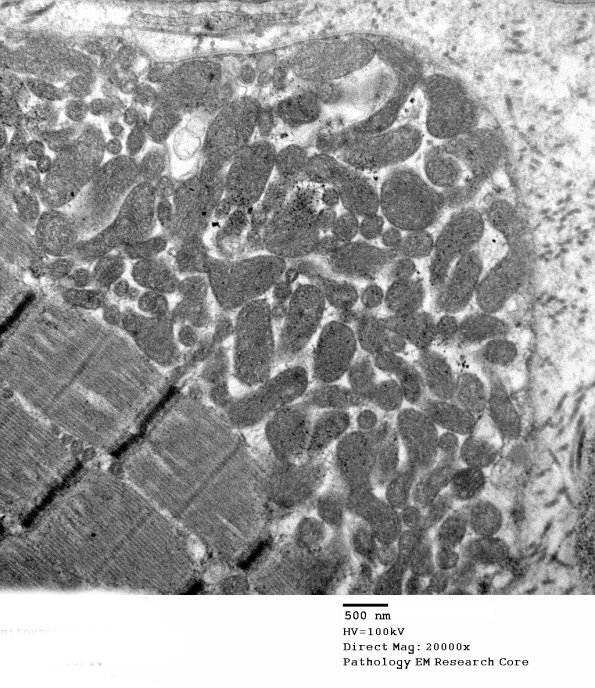 3B10 Case 3 EM005 - Copy