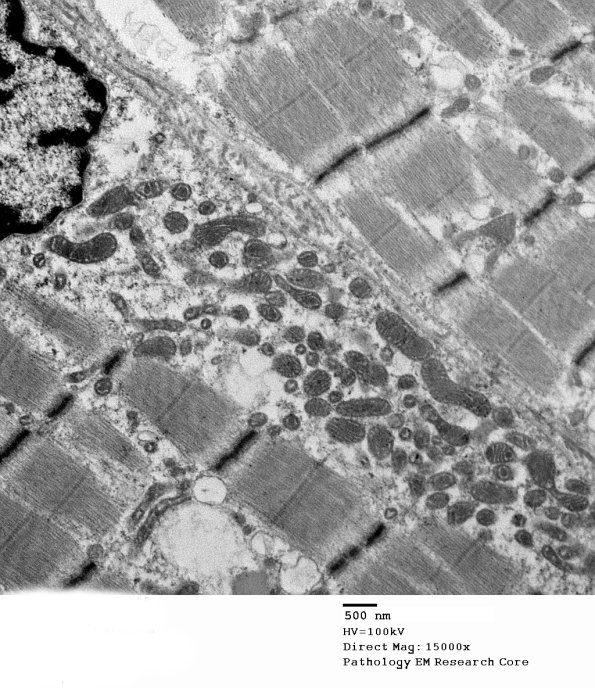3B4B Case 3_002 - Copy