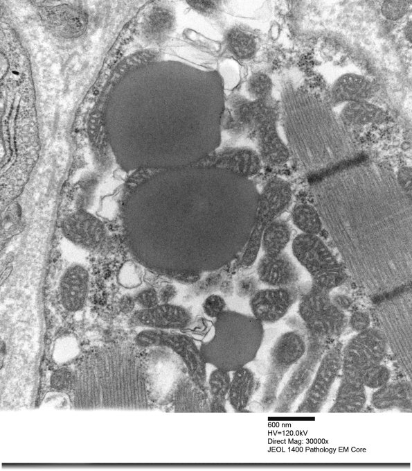 3B5B Mitochondrial myopathy (Case 3)_023 - Copy