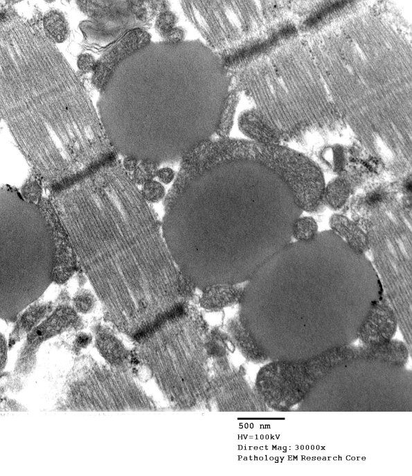 3B5E Mitochondrial myopathy (Case 3)_014 - Copy