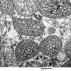 3B6C Case 3 EM011 - Copy