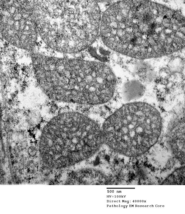 3B6C Case 3 EM011 - Copy