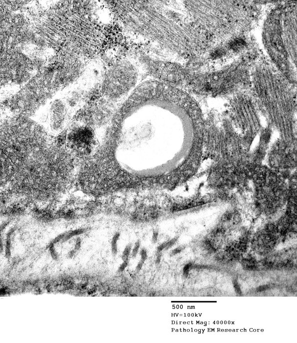 3B9B Case 3 EM028 - Copy