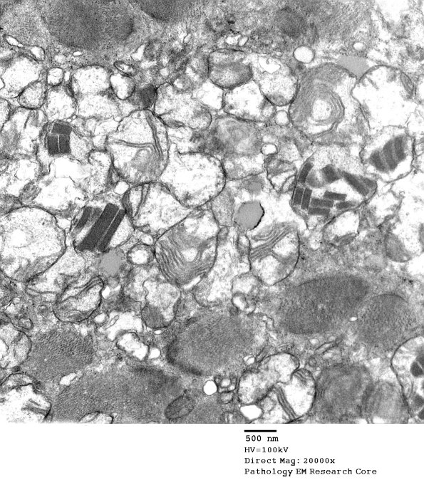 4F1A2 Case 4_021 - Copy