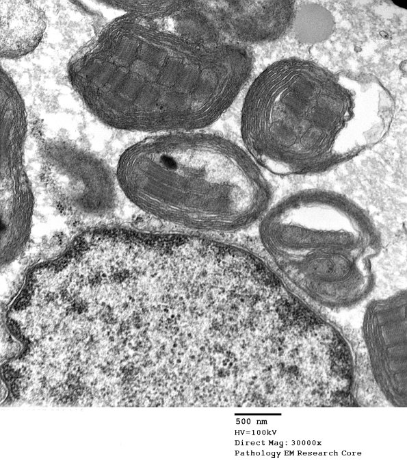 4F5A Case 4_024 - Copy