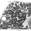 5F1 Case 5_026 - Copy