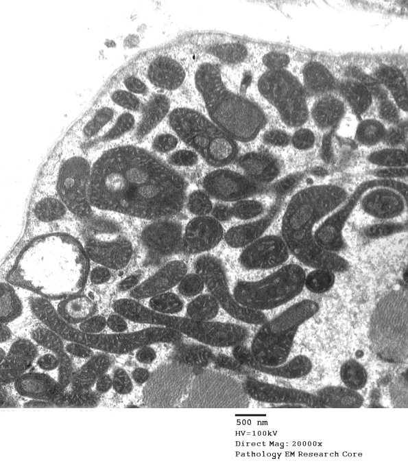5F1 Case 5_026 - Copy