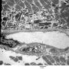 5F2A Case 5_030 - Copy