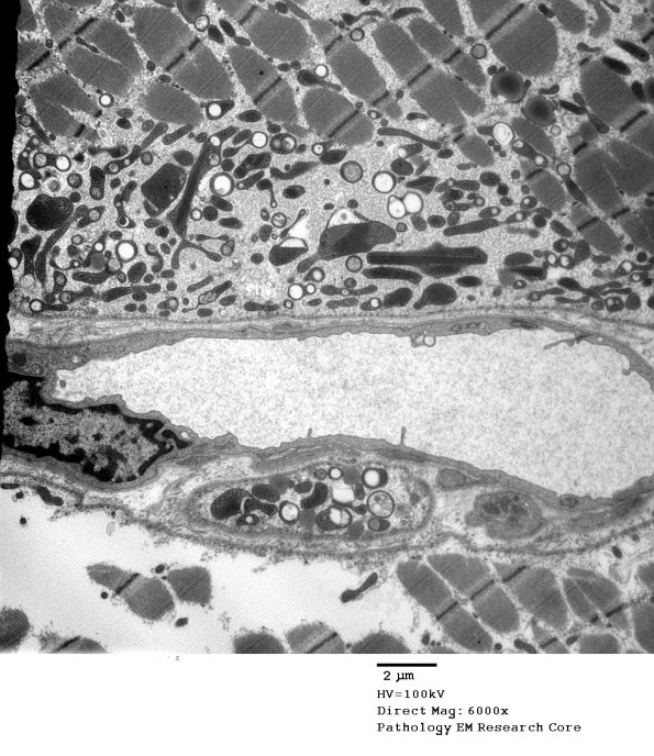 5F2A Case 5_030 - Copy