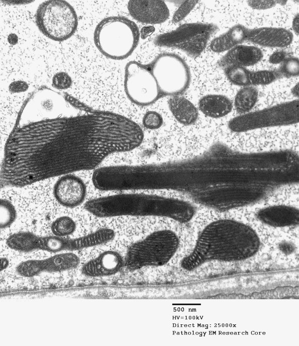 5F2B Case 5_032 - Copy