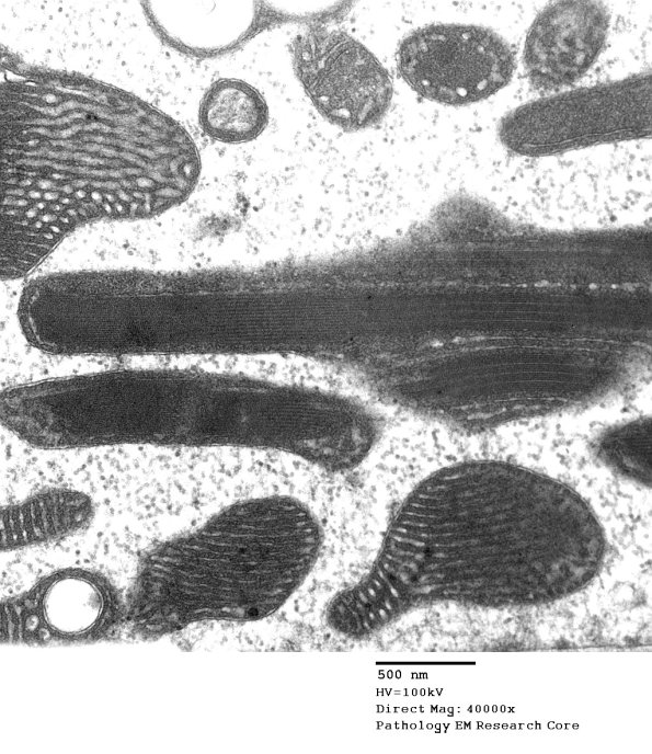 5F2D Case 5_034 - Copy
