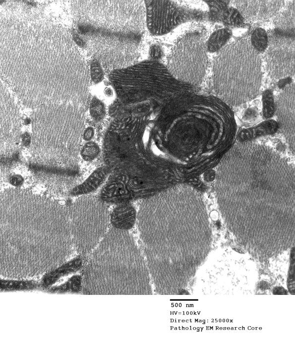 5F3A Case 5_024 - Copy