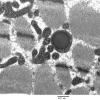 5F6 Case 5_022 - Copy
