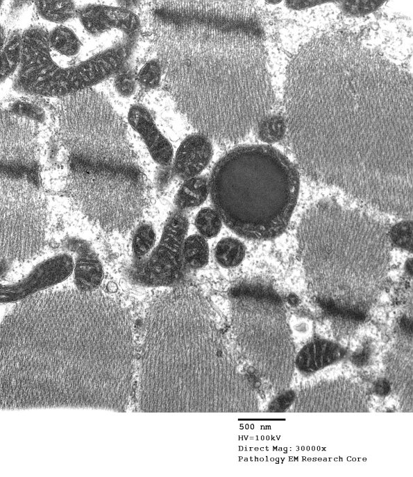 5F6 Case 5_022 - Copy