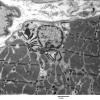 5F7A Case 5_014 - Copy