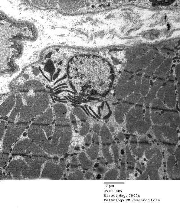 5F7A Case 5_014 - Copy