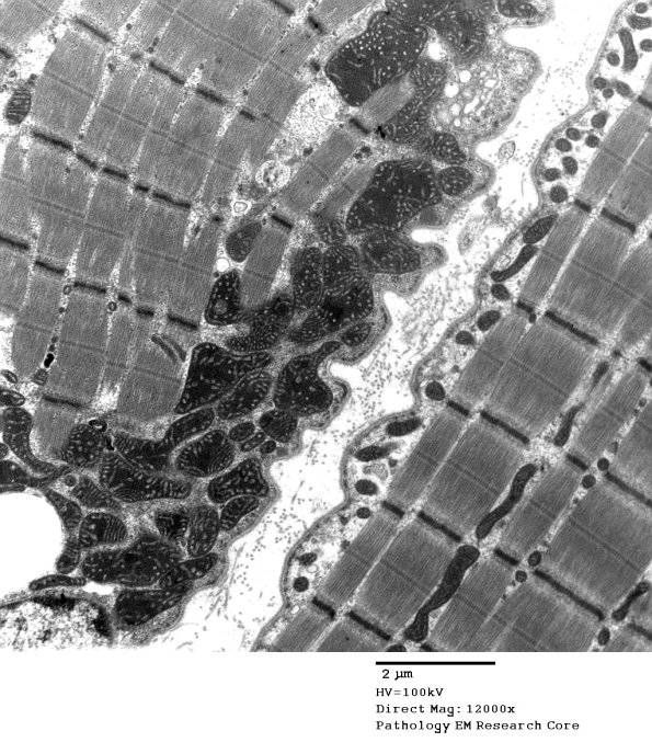 5F9A Case 5_027 - Copy