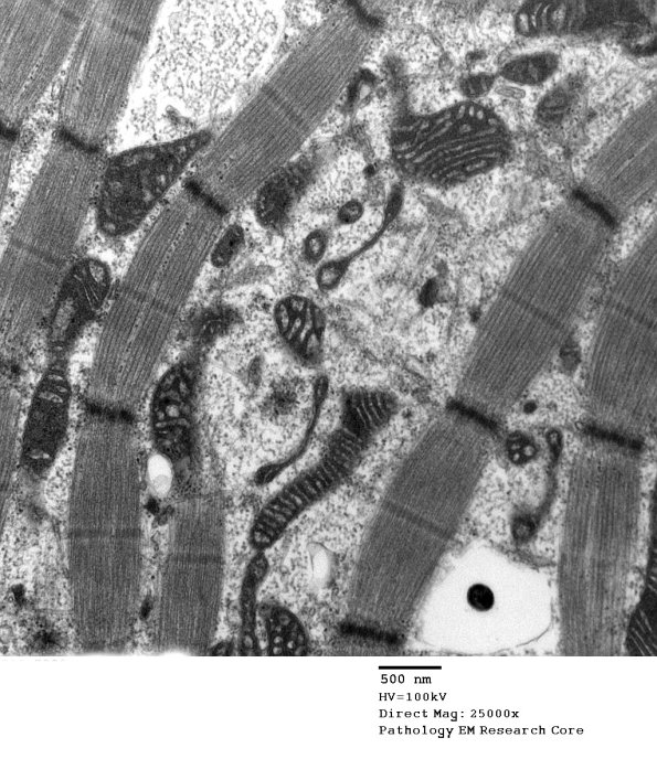 5F9B Case 5_006 - Copy