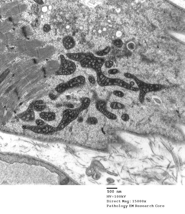 5F9C Case 5_010 - Copy
