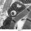 5F9D Case 5_008 - Copy