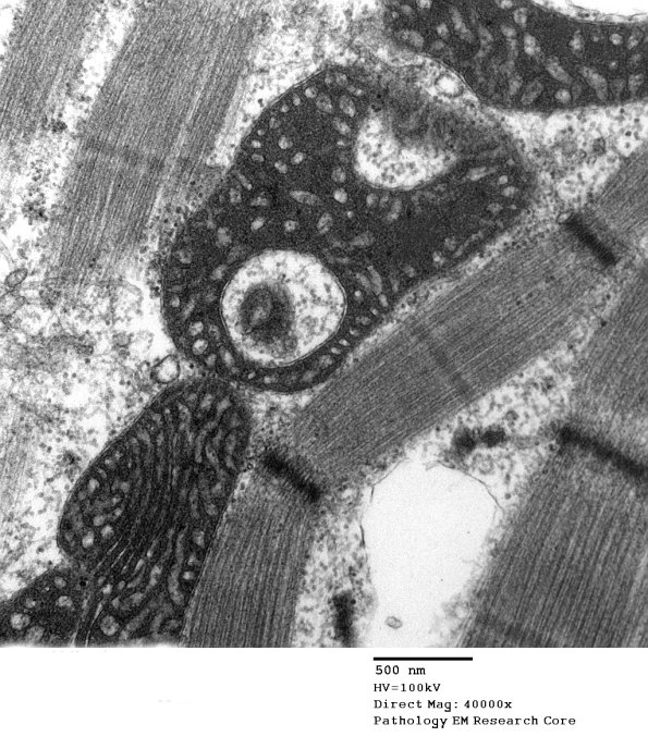 5F9D Case 5_008 - Copy
