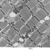 7A3 Mitochondriopathy (Case 7) EM 005 - Copy