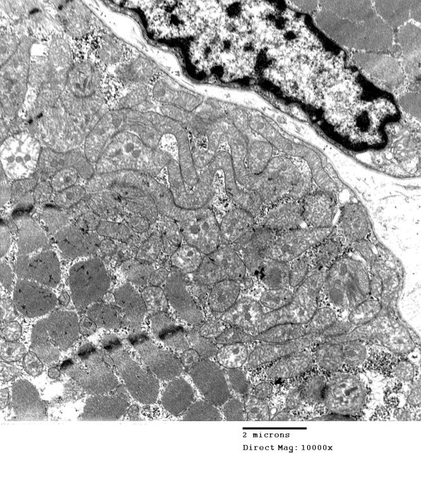 8A1B Mitochondrial Myopathy (Case 8) 042 - Copy