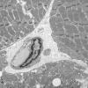 8A2 Mitochondrial Myopathy (Case 8) 034 - Copy