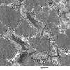 8A5B Mitochondrial Myopathy (Case 8) 012 - Copy