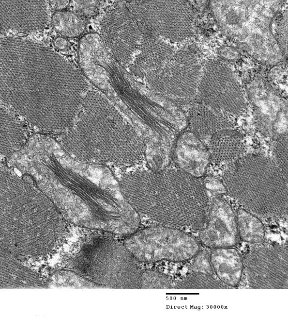 8A5B Mitochondrial Myopathy (Case 8) 012 - Copy