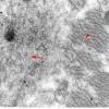 1E6 Myosin Loss Myopathy, patchy (Case 1) 022 copy - Copy