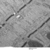 2C1B (Case 2) EM007 - Copy