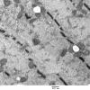 2C9B (Case 2) EM002 - Copy