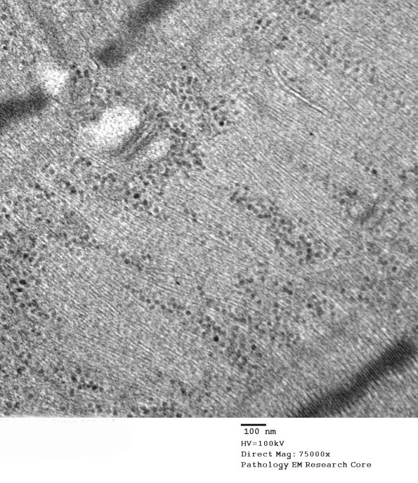 2C9C (Case 2) EM008 - Copy