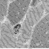 4C1 Myosin loss myopathy & mitochondriopathy (S09-26925) EM 001 - Copy