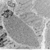 4C2 Myosin loss myopathy & mitochondriopathy (S09-26925) EM 011 - Copy (2)