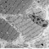 4C3 Myosin loss myopathy & mitochondriopathy (S09-26925) EM 007 - Copy