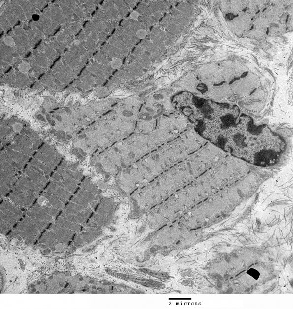 4C3 Myosin loss myopathy & mitochondriopathy (S09-26925) EM 007 - Copy