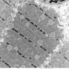 4C5 Myosin loss myopathy & mitochondriopathy (S09-26925) EM 006 - Copy