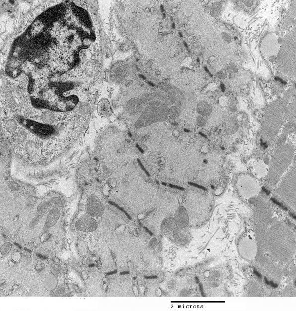 4C6 Myosin loss myopathy & mitochondriopathy (Case 4) EM 003 - Copy