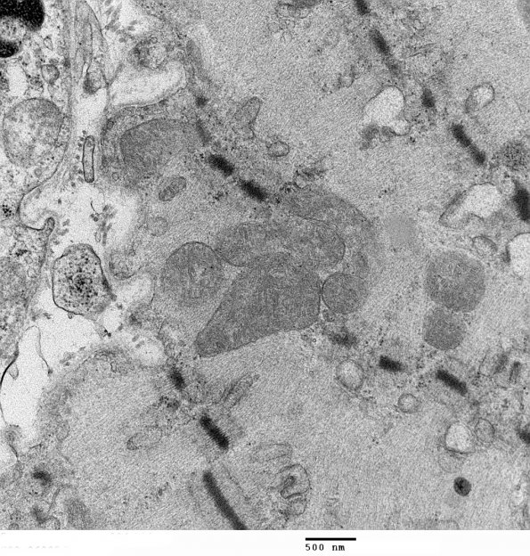 4C7 Myosin loss myopathy & mitochondriopathy (S09-26925) EM 004 - Copy