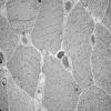 9B6 (Case 9) EM004 - Copy