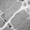 9B7 (Case 9) EM048 - Copy