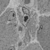 9D7 (Case 9) EM041 - Copy