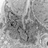 9D8 (Case 9) EM043 - Copy