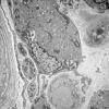 9D9 (Case 9) EM054 - Copy