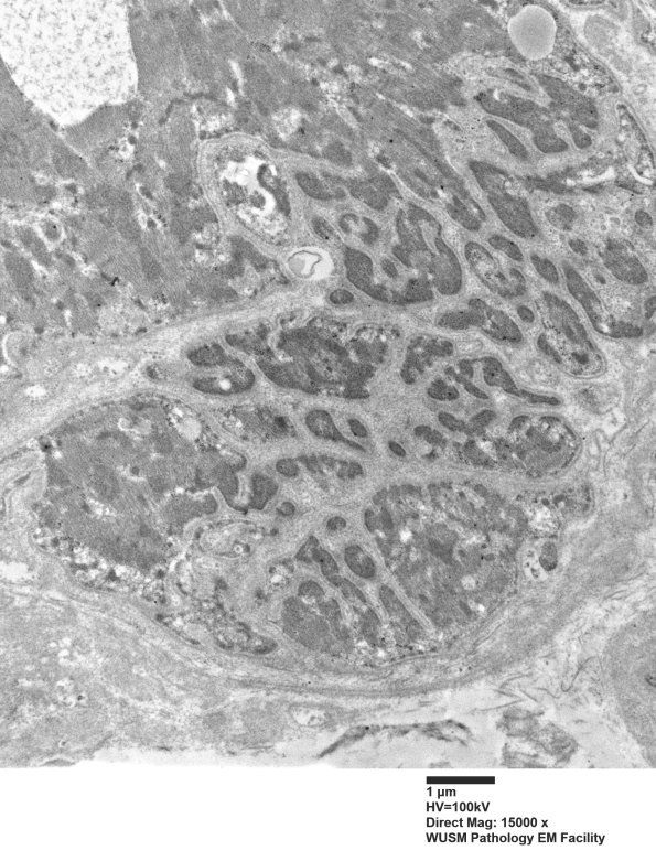 10C1A (Case 10) EM048 - Copy