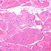 Myotendinous junction