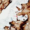 2B-Muscle-tendon-insertion-zone-Case-2-desmin-copy.jpg